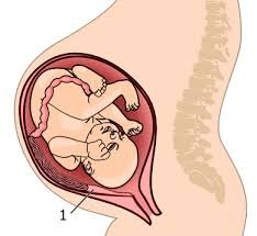 Common Pregnancy Problems Every Woman Should Know About – 2025